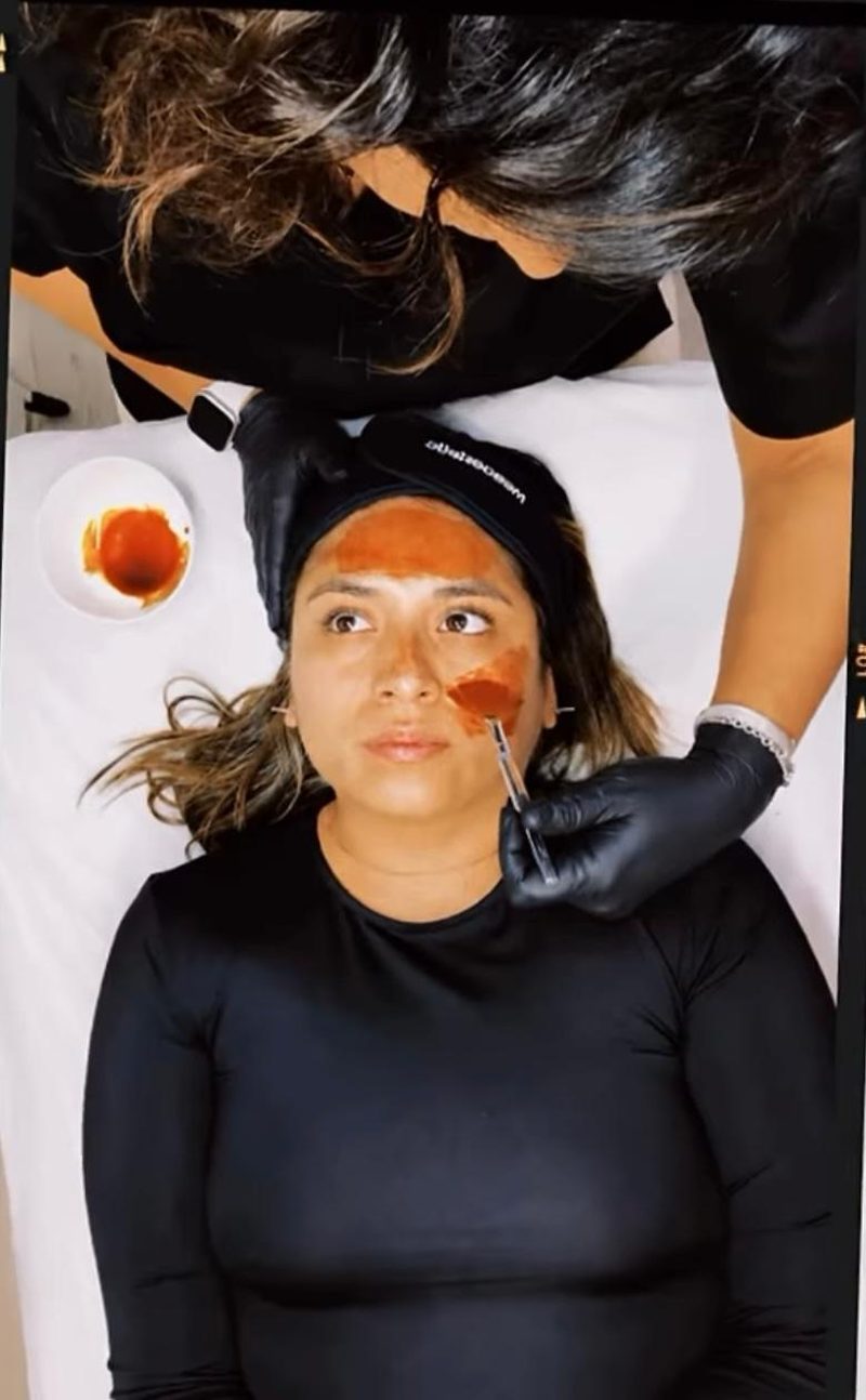 Tractaments facials a ValeriCare Sabadell